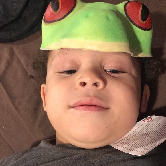 Wild Republic Red Eyed Frog Head Mask - Picture 2 of 3